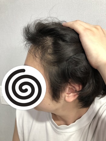 수술후
