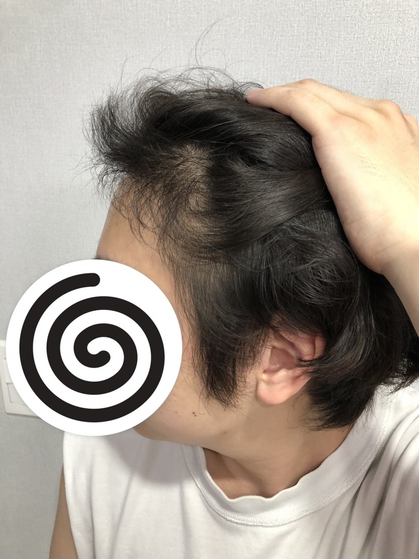 수술후
