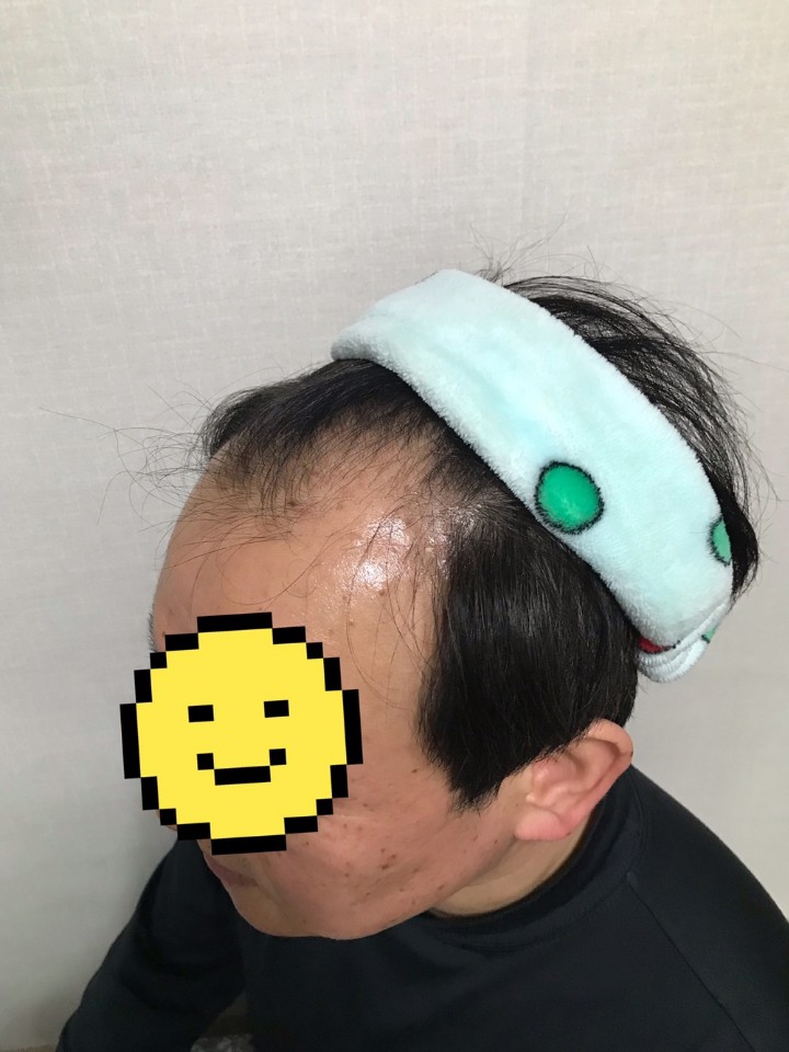 수술 전