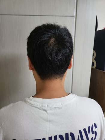 6개월차