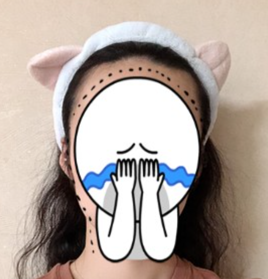 일주일 전 (모발이식 하기 전이에요)