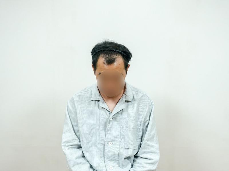 [자라다의원] 수술 1년 2개월 / AS 7개월 후기