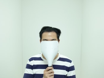 &lt;수술 1년 2개월 후&gt;