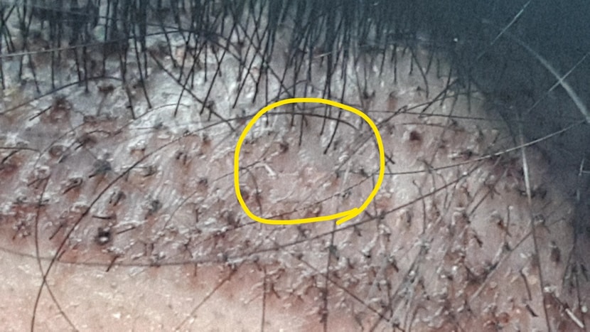 6일차 아침 확대사진