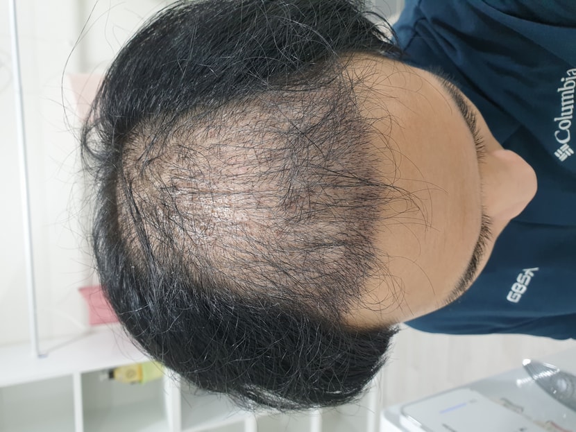 정면