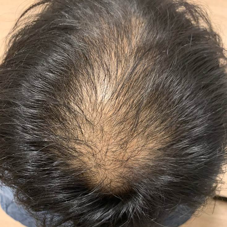 수술 전