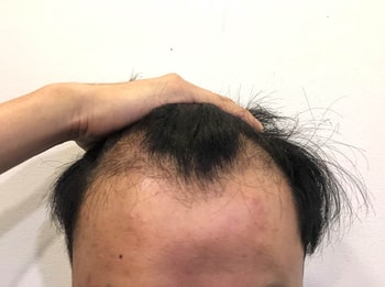 &lt;현재 3개월입니다&gt;