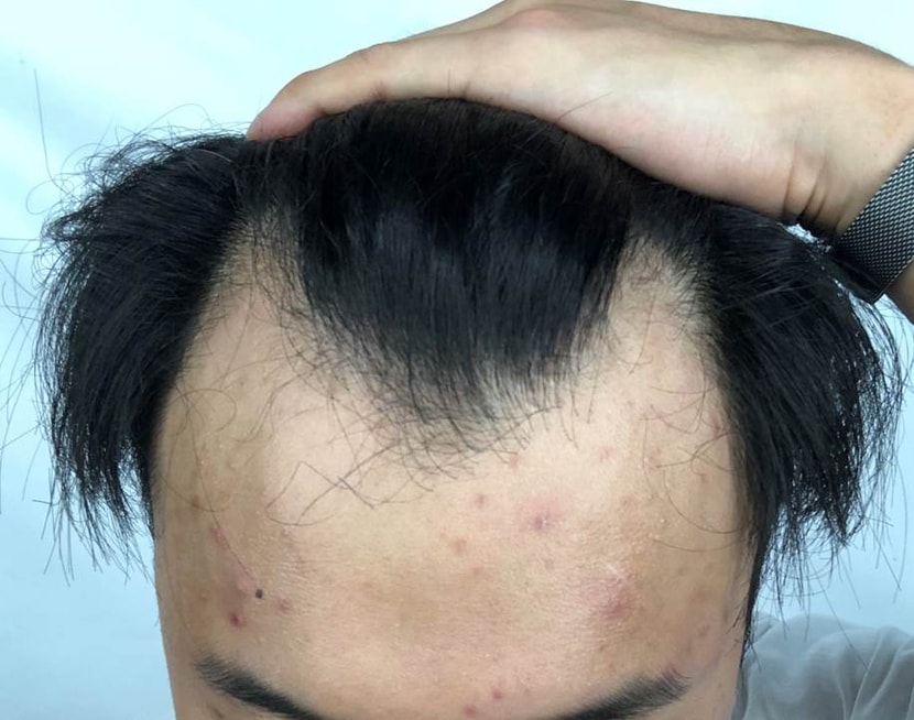 &lt;수술전입니다&gt;