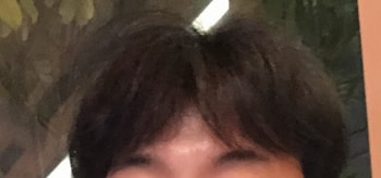 수술전 평상시 모습입니다.