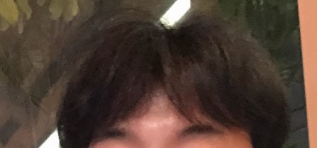 수술전 평상시 모습입니다.