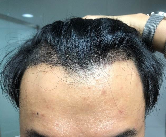 &lt;수술후입니다&gt;