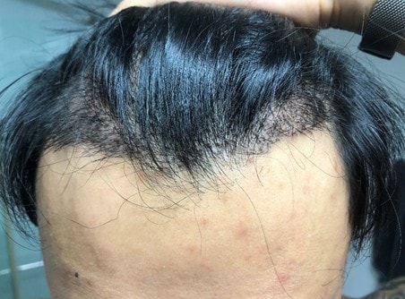 수술후입니다. ^^ 