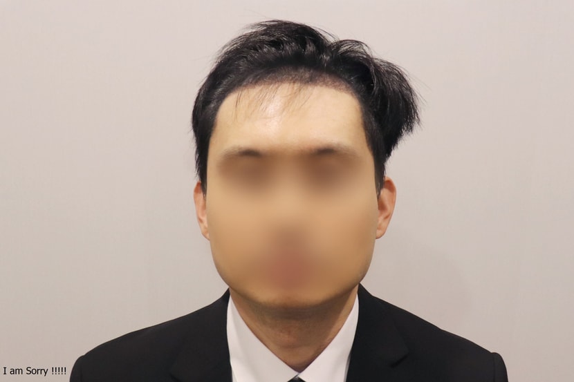 수술후