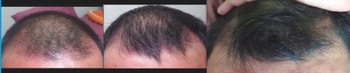 정면 5월31일, 6월23일, 8월15일,