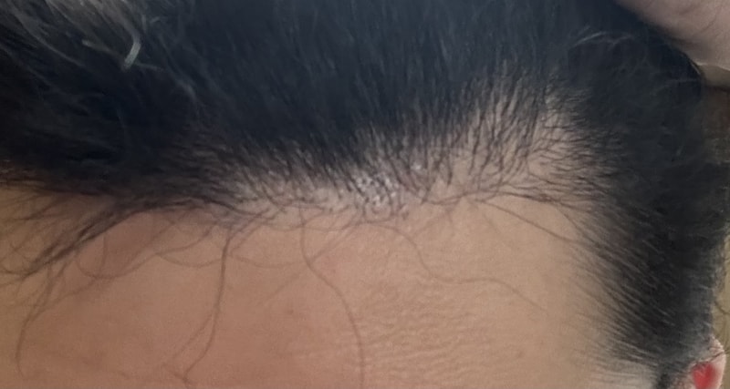 请帮我看一下移植第8个月怎么样。