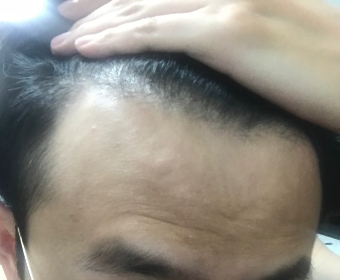 [1] 수술날짜 잡았습니다.