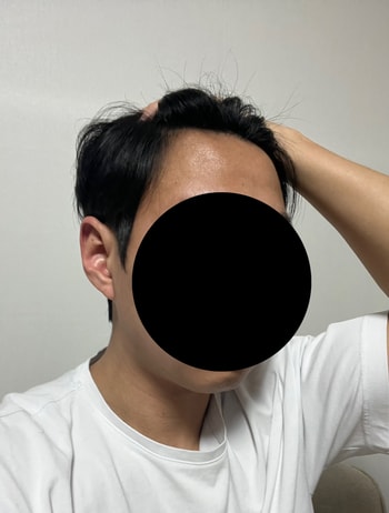수술전