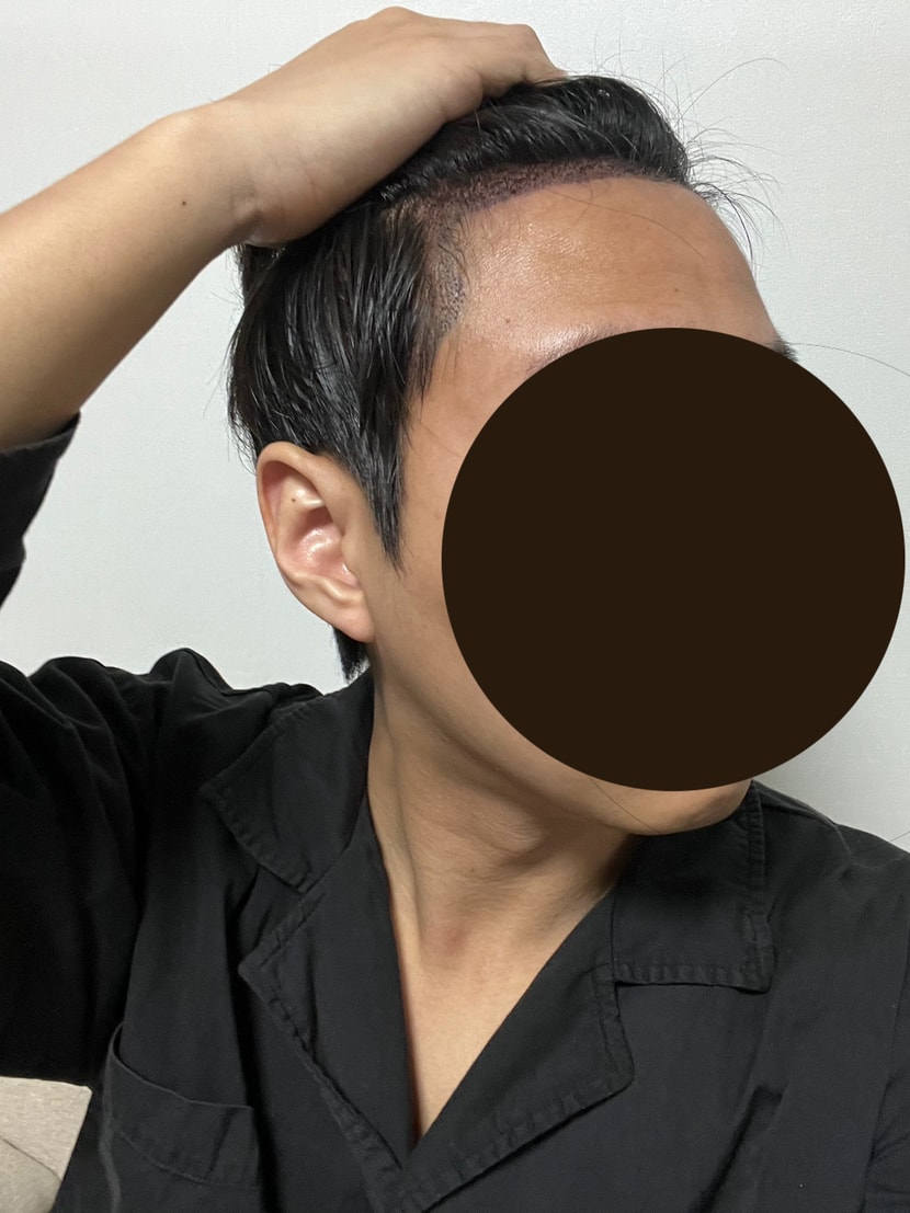 2일차