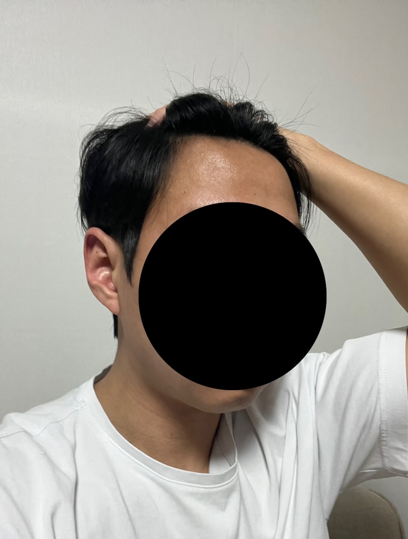 수술전