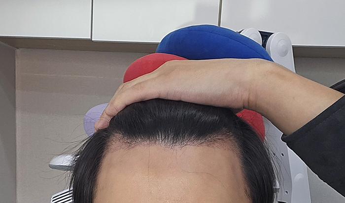 1개월 정면