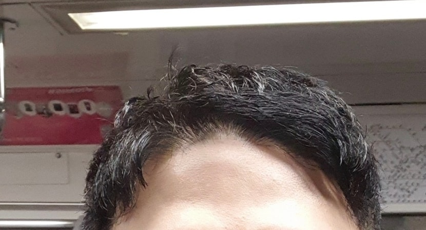 전