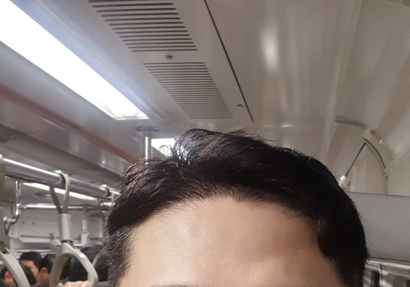 후