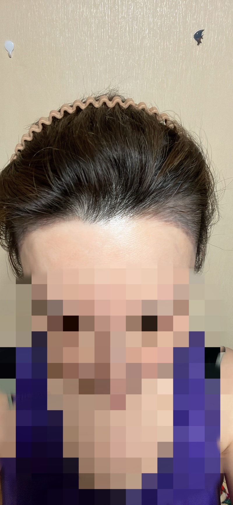 とても不安です..