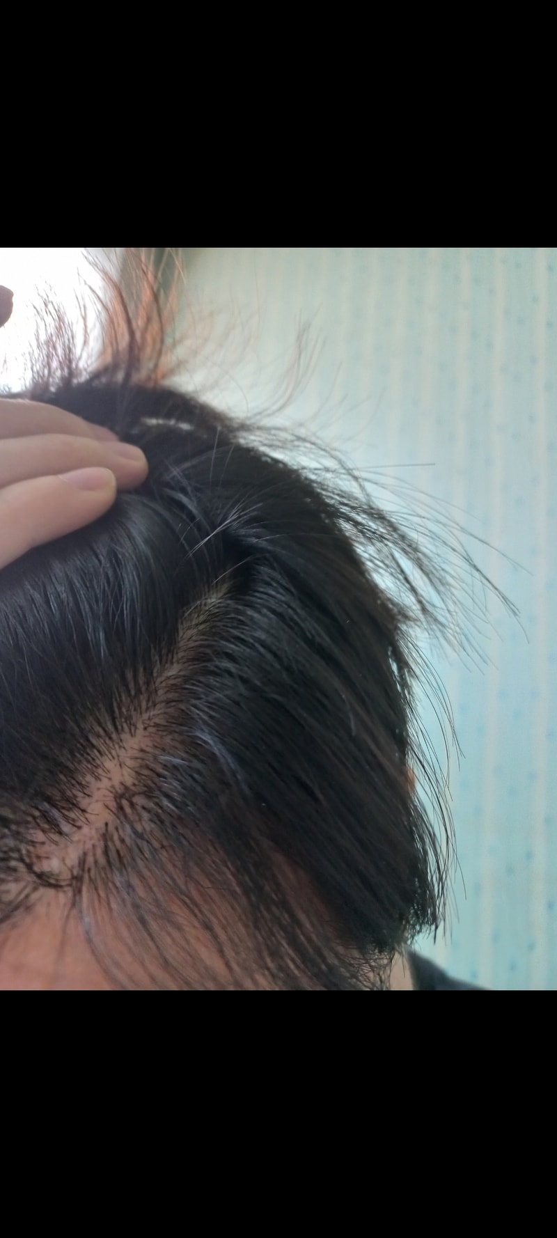 这种程度的话，密度需要加强吗？