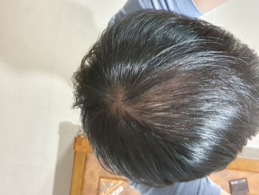 수술 전 평소사진