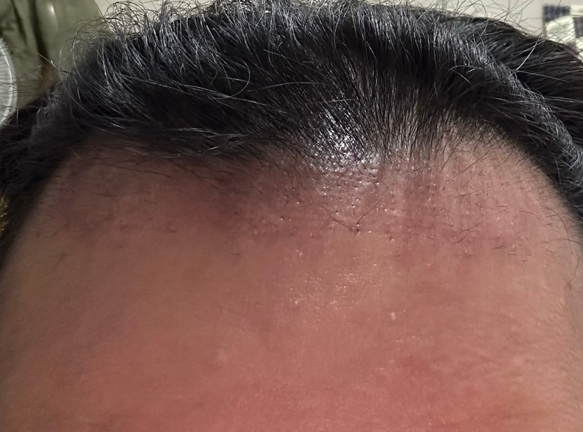 암흑기 심하게 온 2개월 차