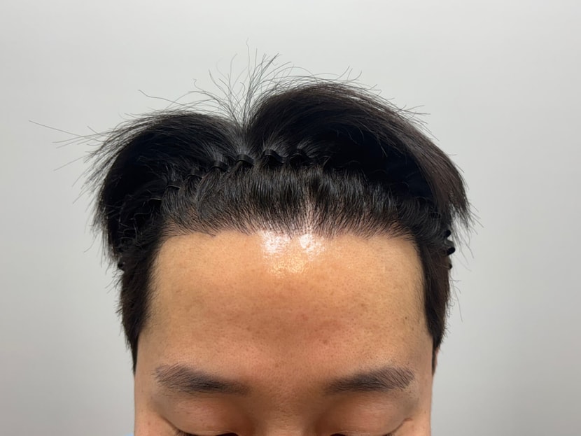 1년차