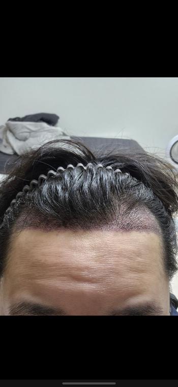 정면