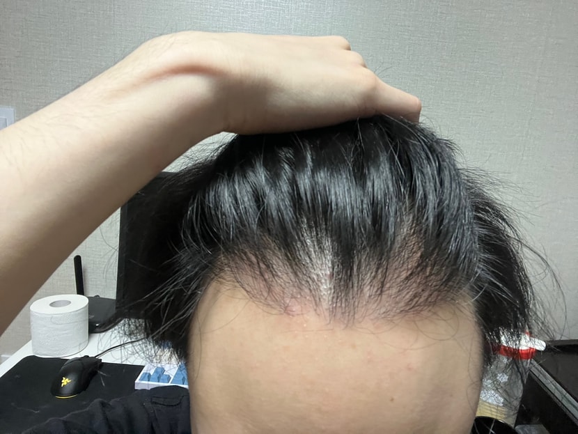 마른 머리