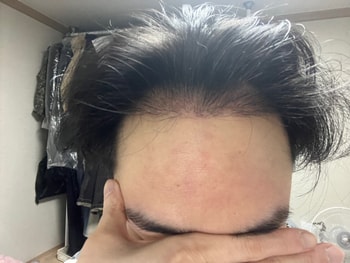 마른 머리
