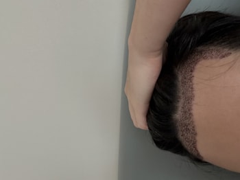 어떤가료