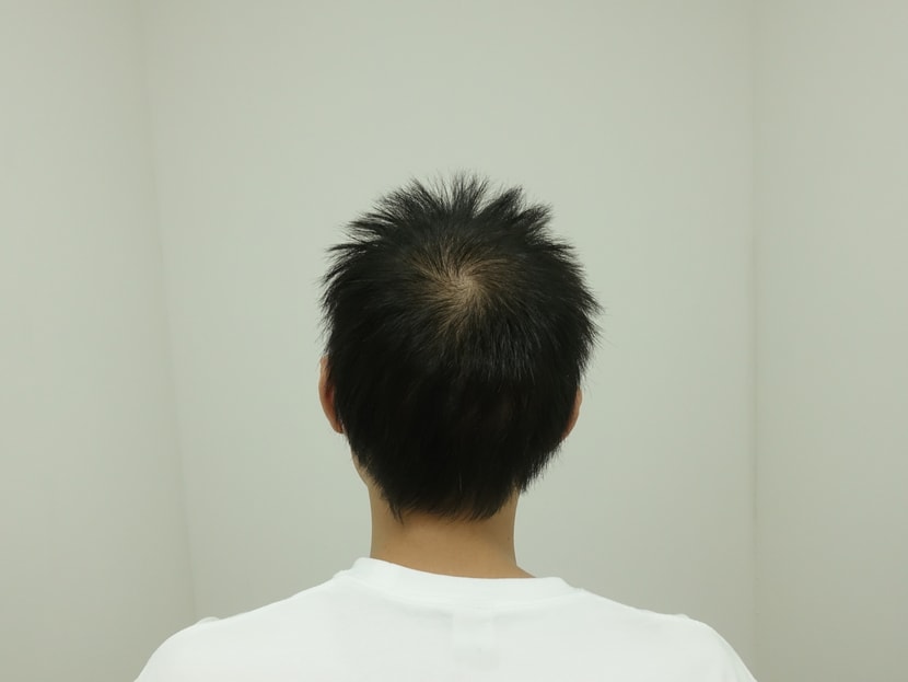 수술 후