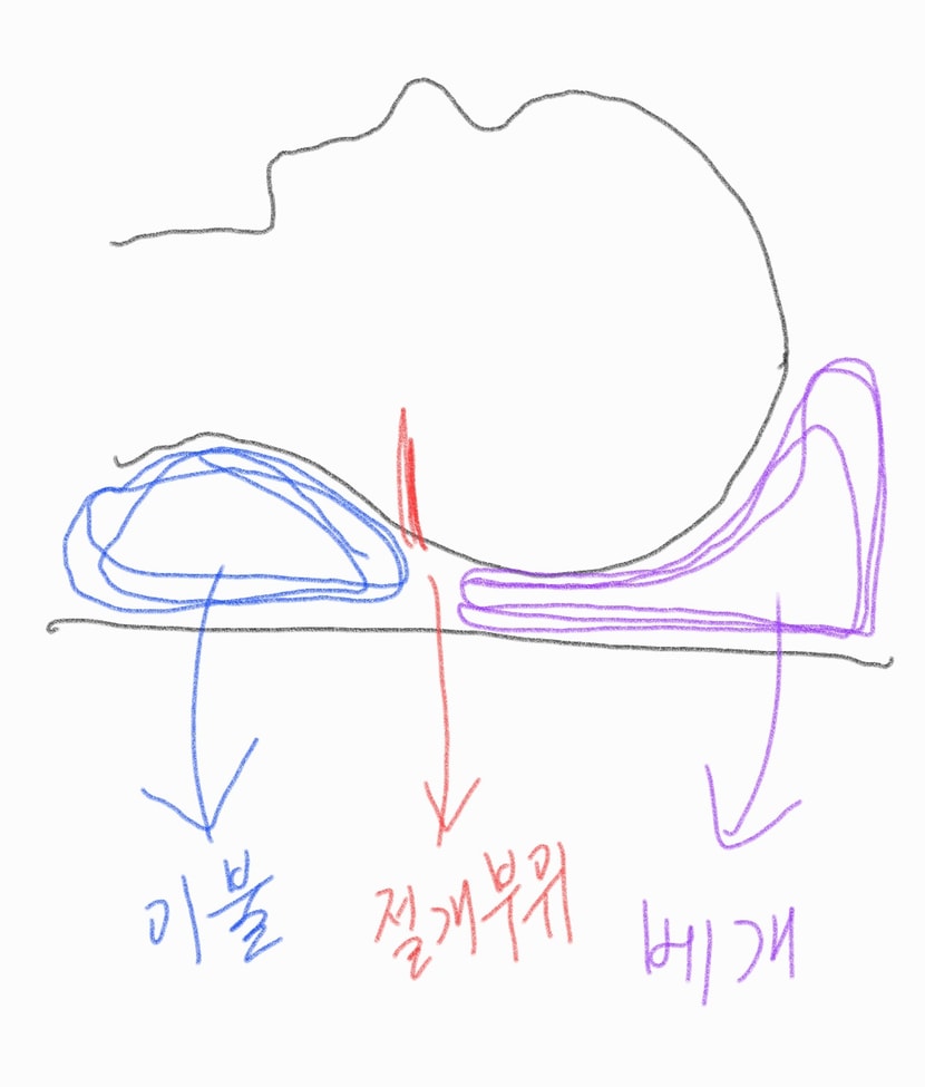 1번 측면