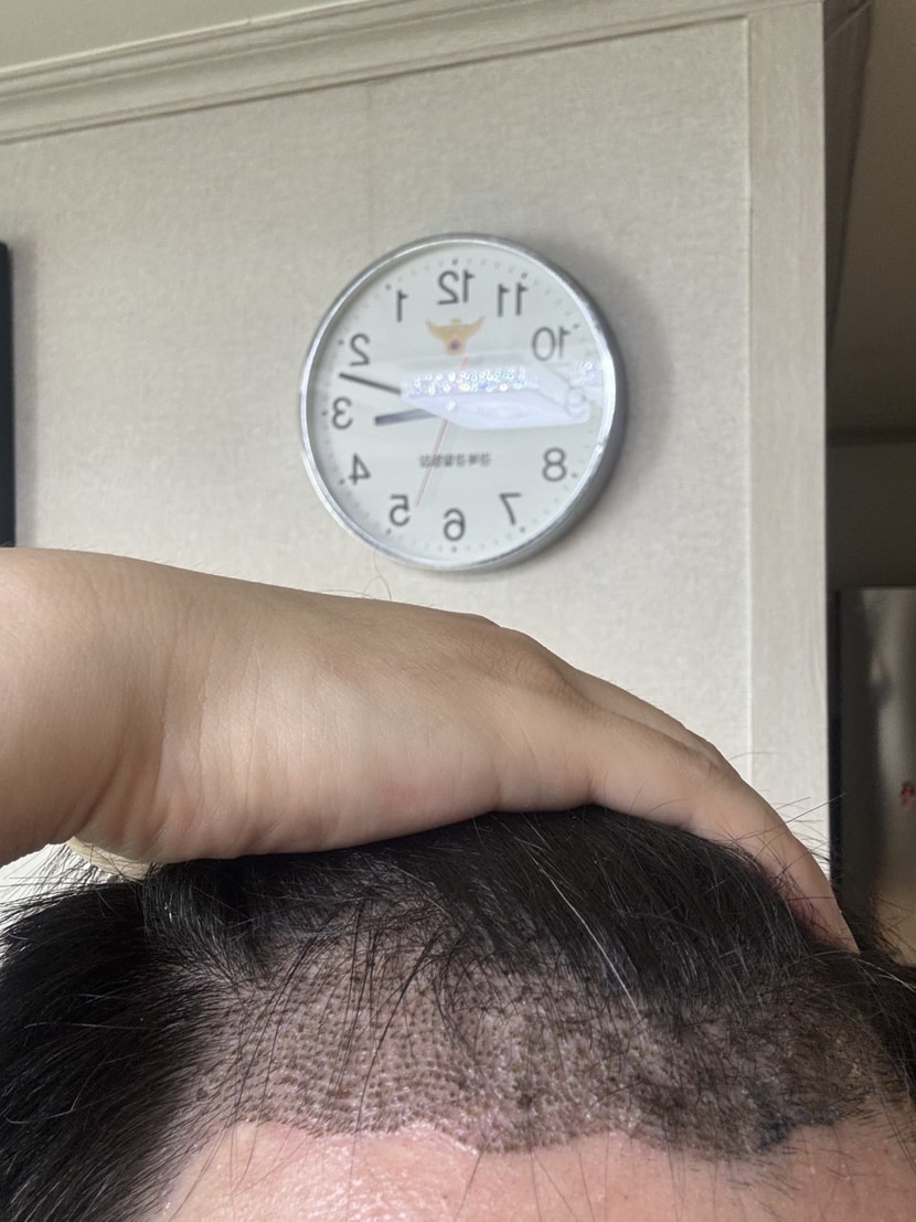 7일차 왼쪽