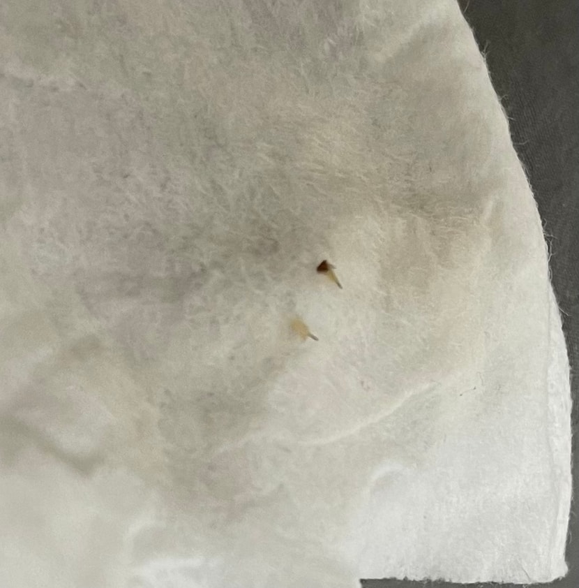 각질 제거시 이탈되는 모발
