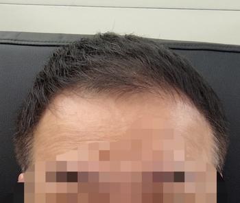 수술전
