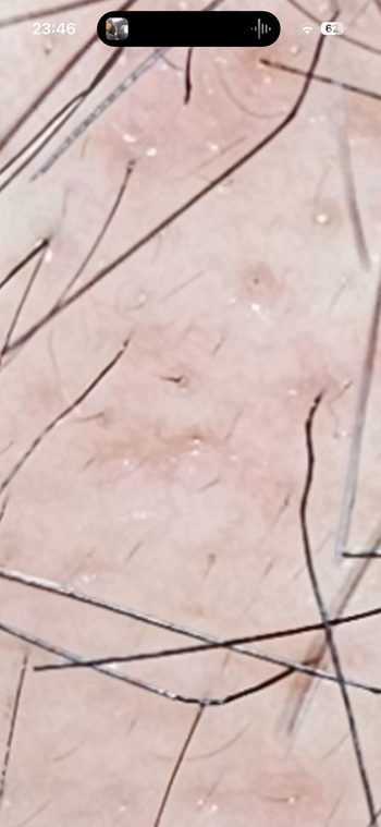 초근접
