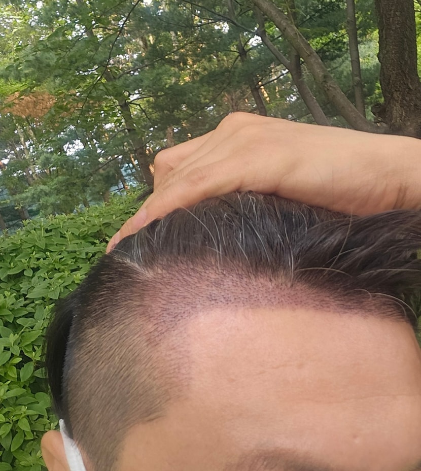 10일차