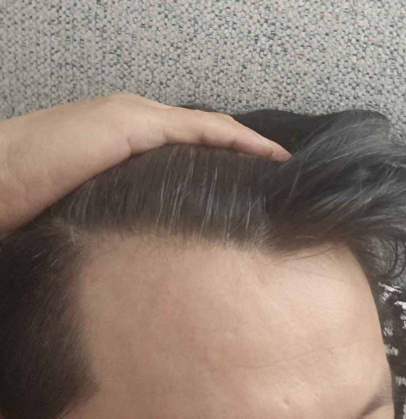 수술전