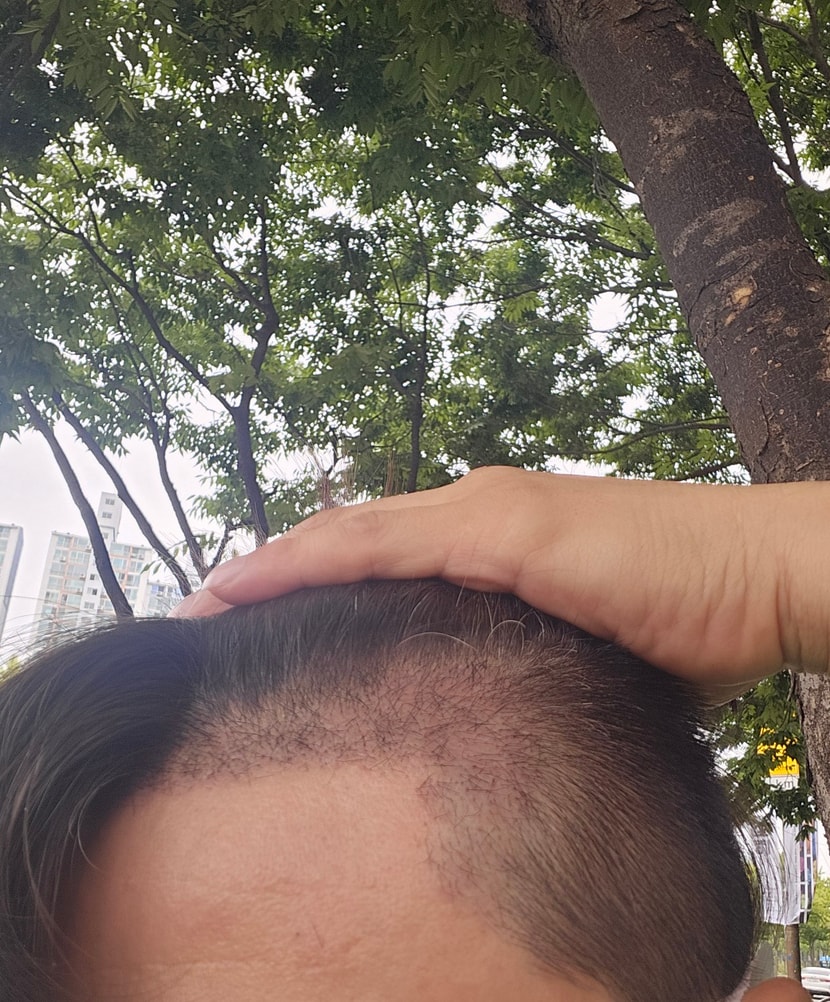 현재상태