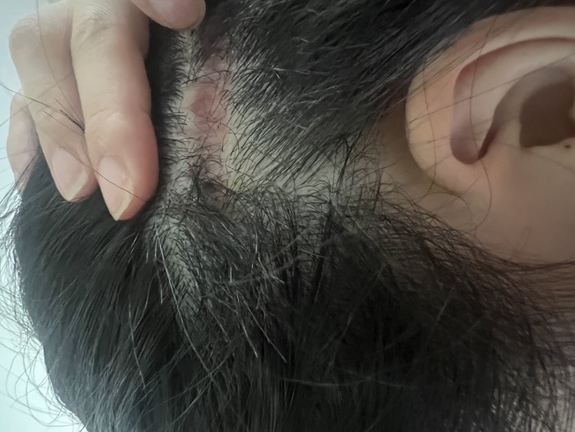 후레쉬 없는 왼쪽