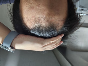 34일차