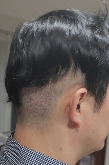 3일차 우측면