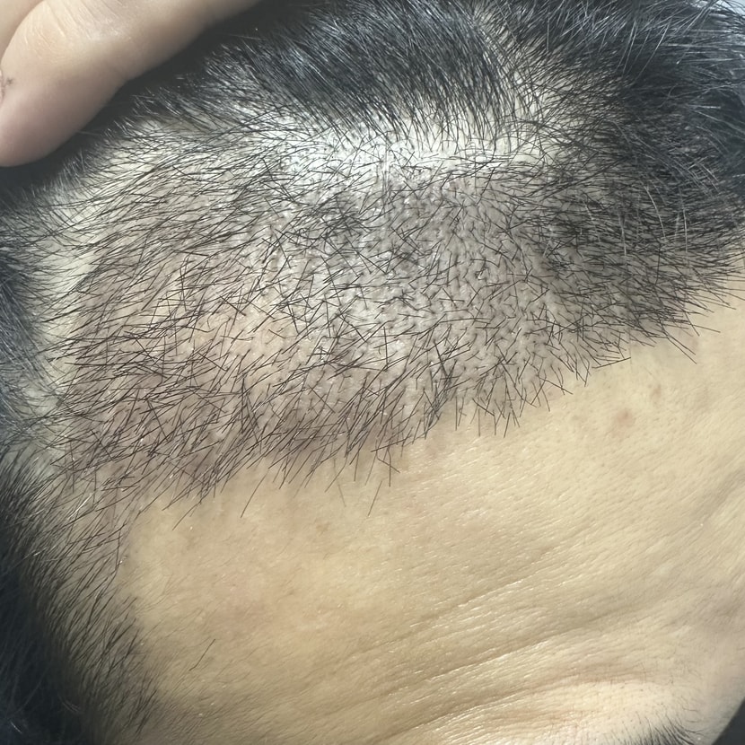 3주차 오늘 오른쪽