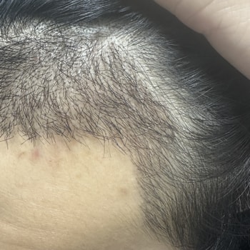 3주차 오늘 왼쪽