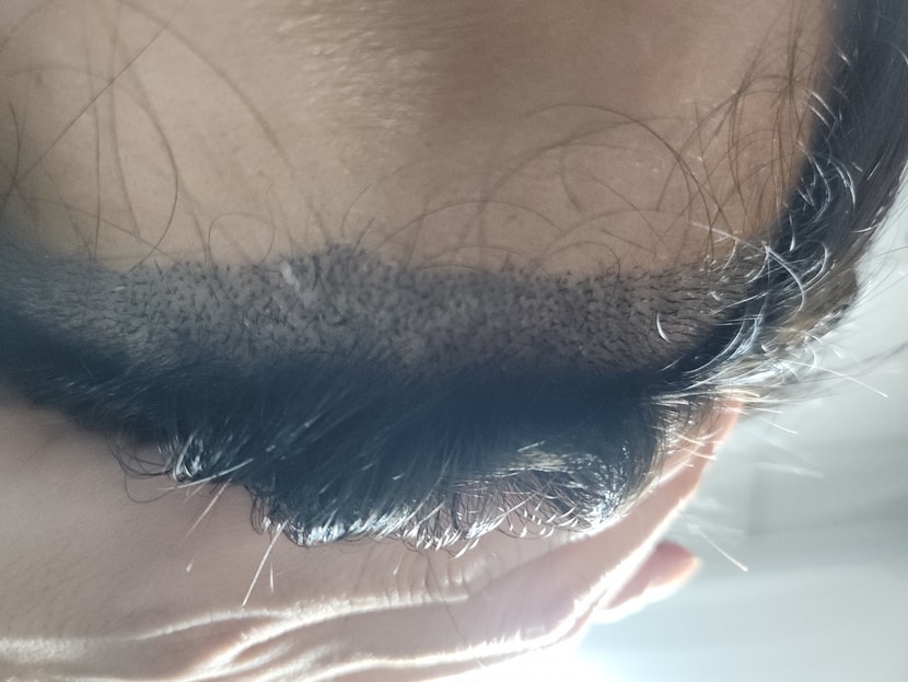 9일